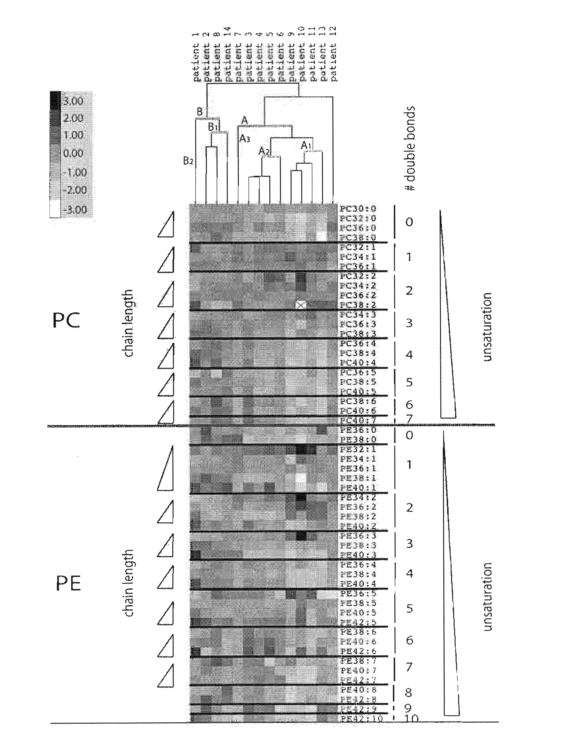 Cancer phospholipidome