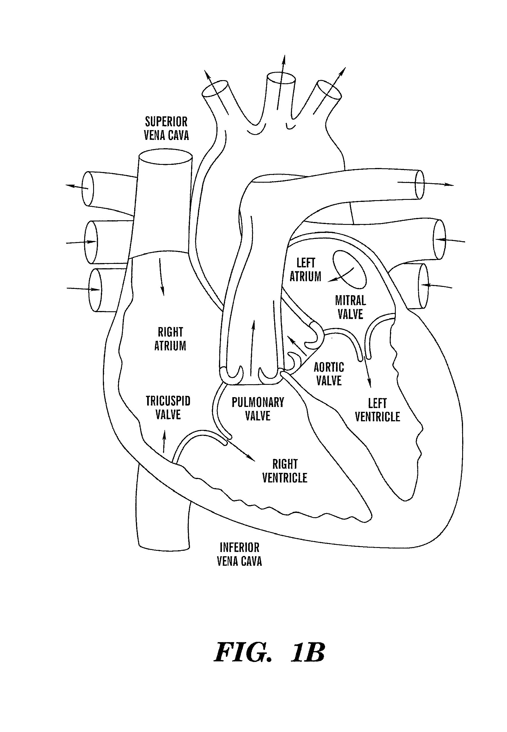 System and method for inferring disease similarity by shape matching of ECG time series