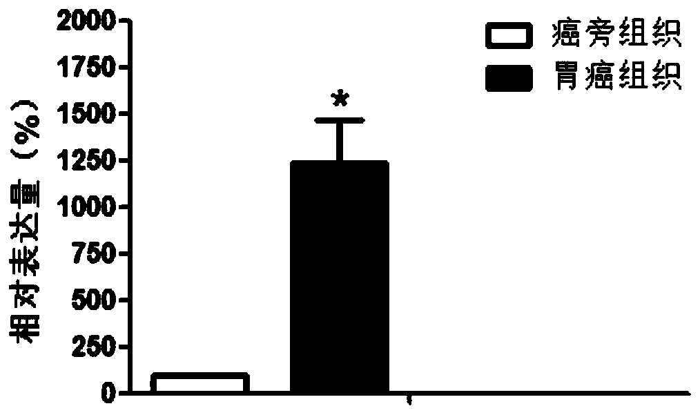 Use of linc01836 in the preparation of gastric cancer diagnostic products and therapeutic drugs