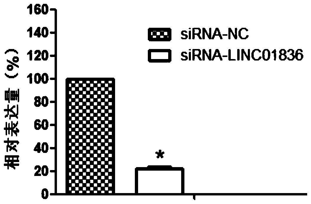 Use of linc01836 in the preparation of gastric cancer diagnostic products and therapeutic drugs