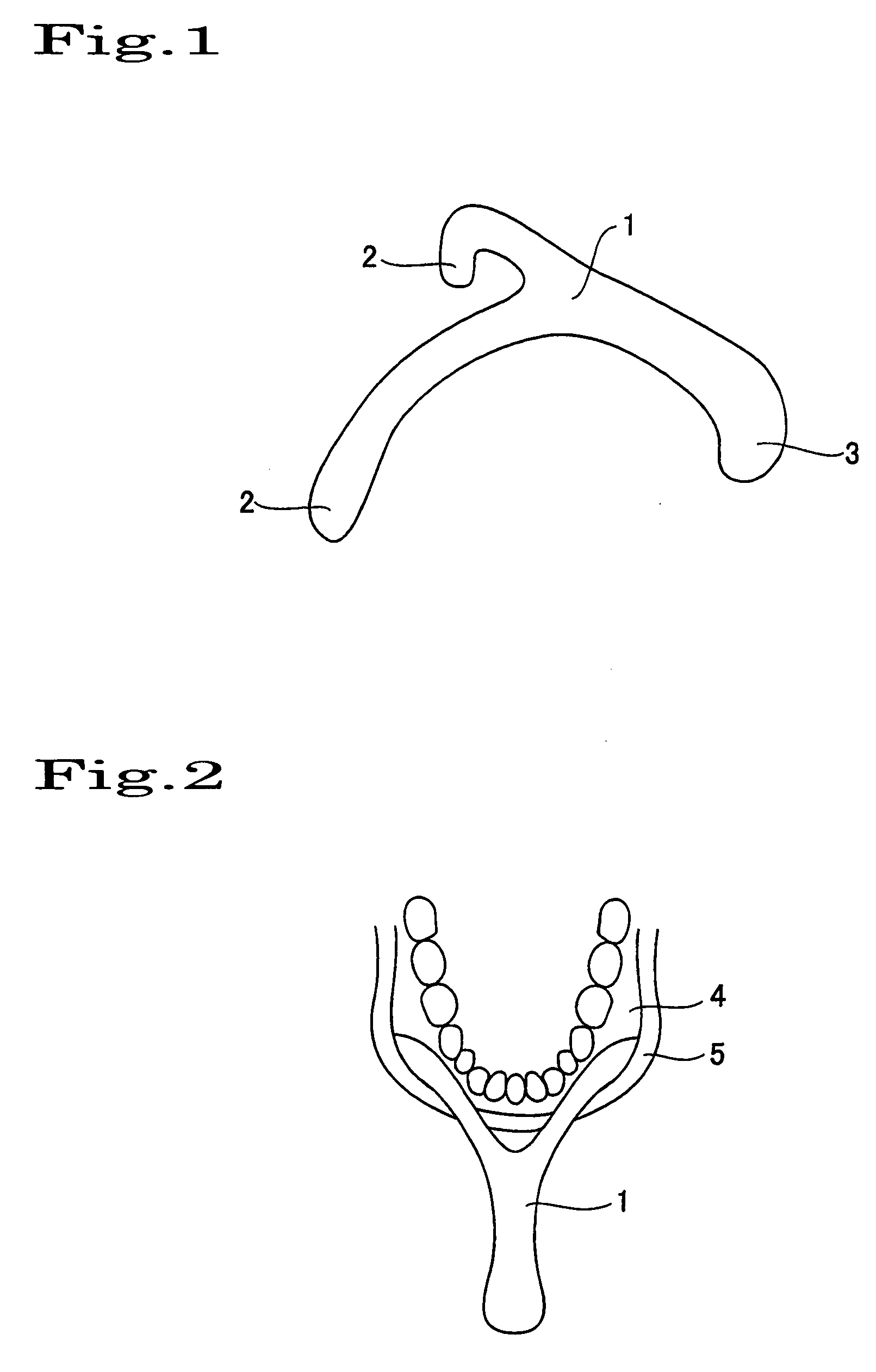 Cheek-Thinning Instrument