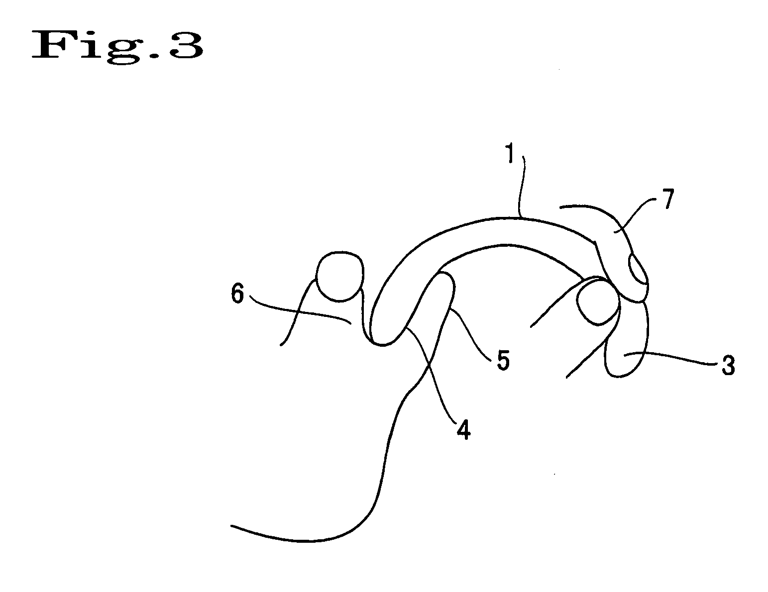 Cheek-Thinning Instrument