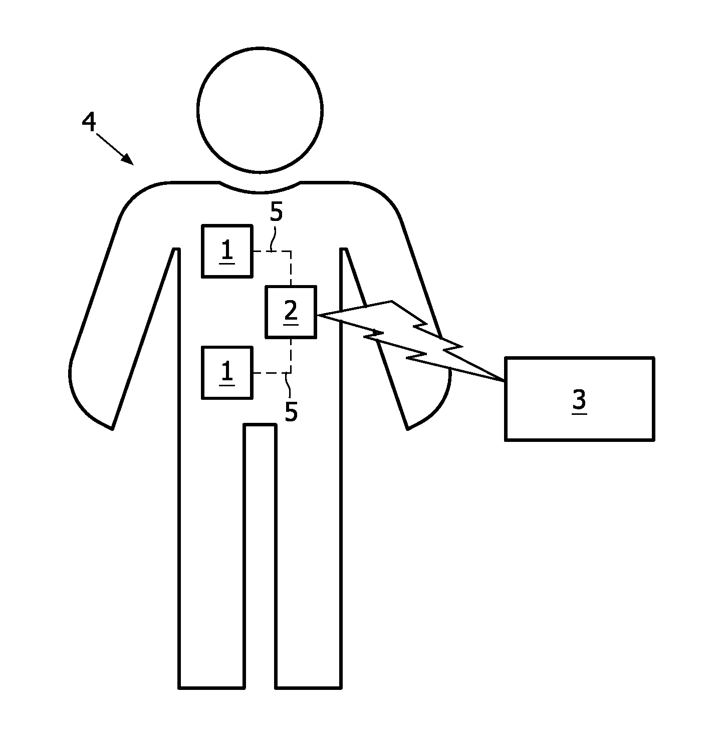 Wireless patient monitoring using streaming of medical data with body-coupled communication