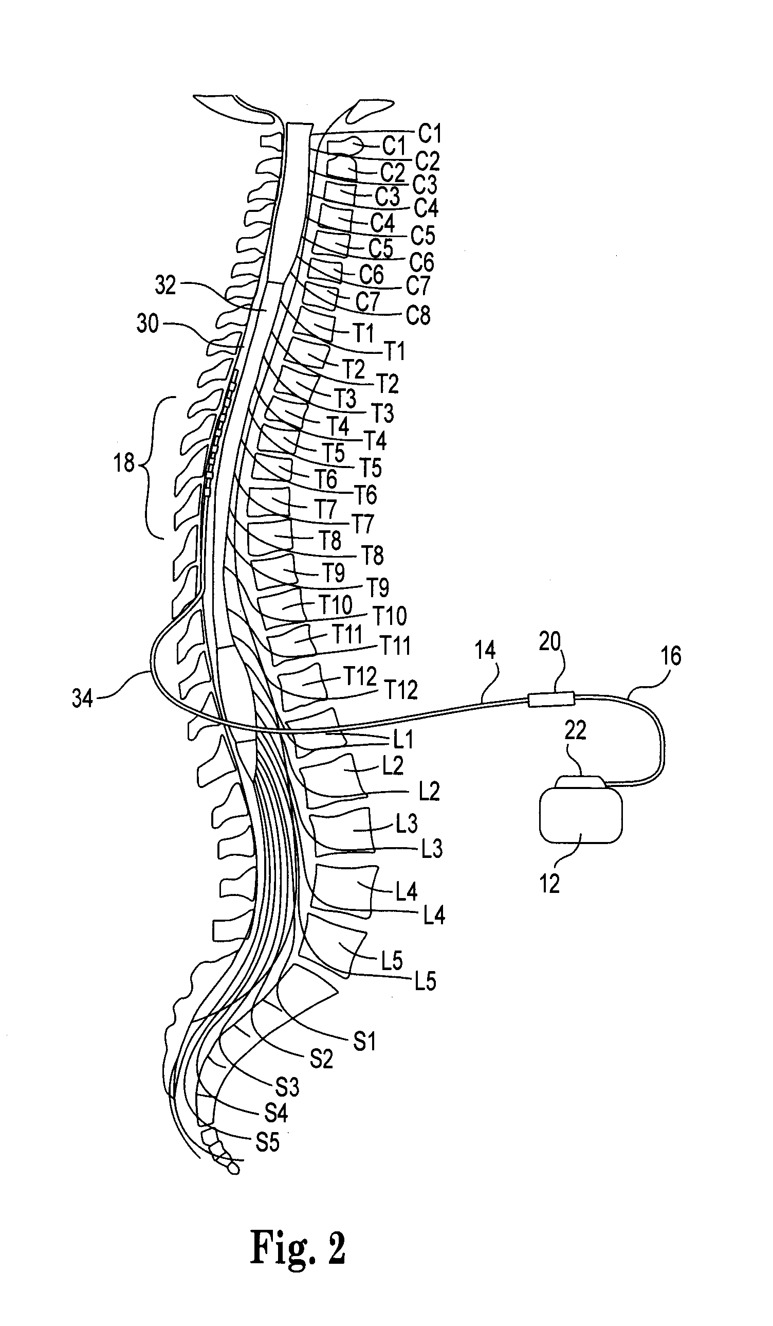 Low insertion force electrical connector for implantable medical devices