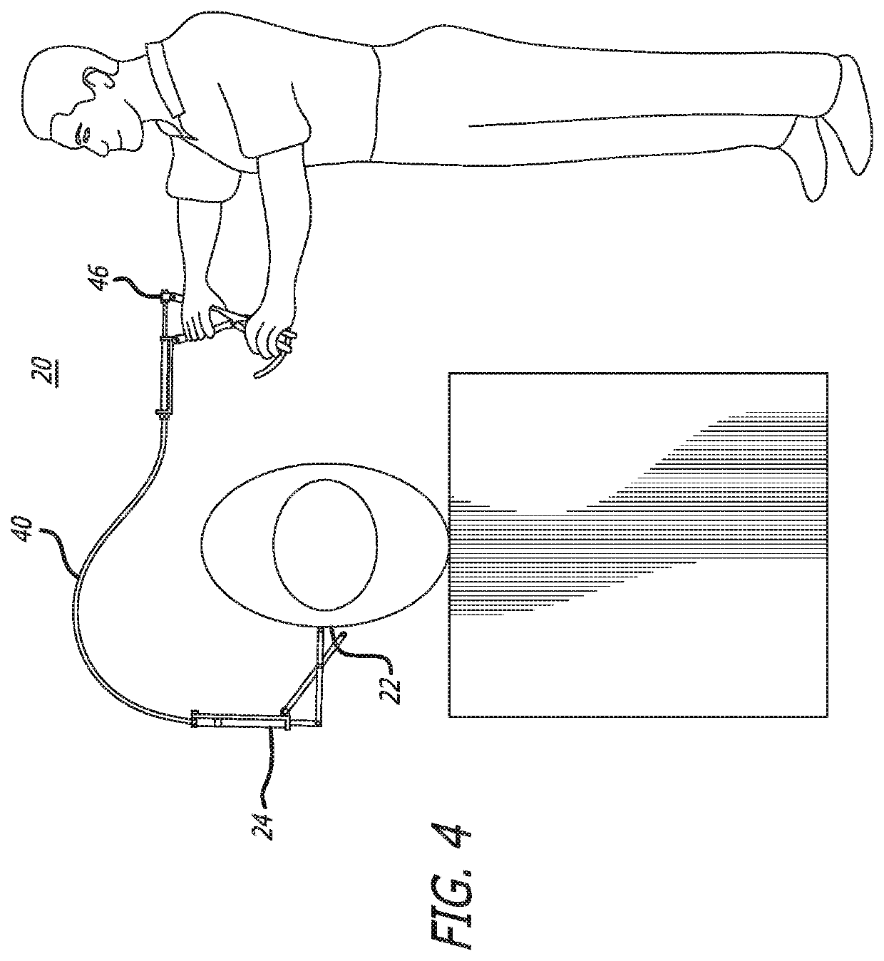 Remote spinal manipulating assembly and method for remote spinal manipulation