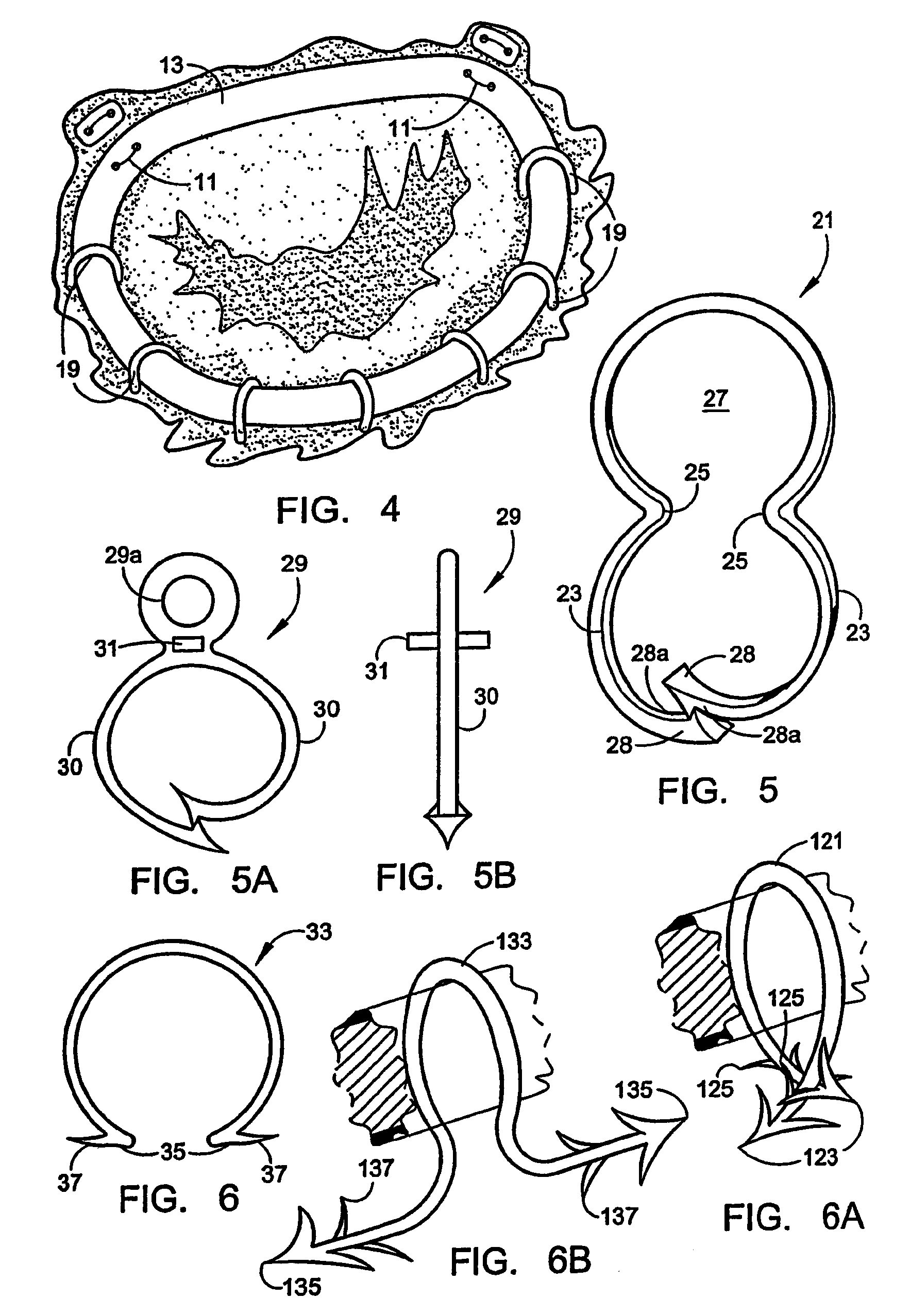 Implantation system for annuloplasty rings