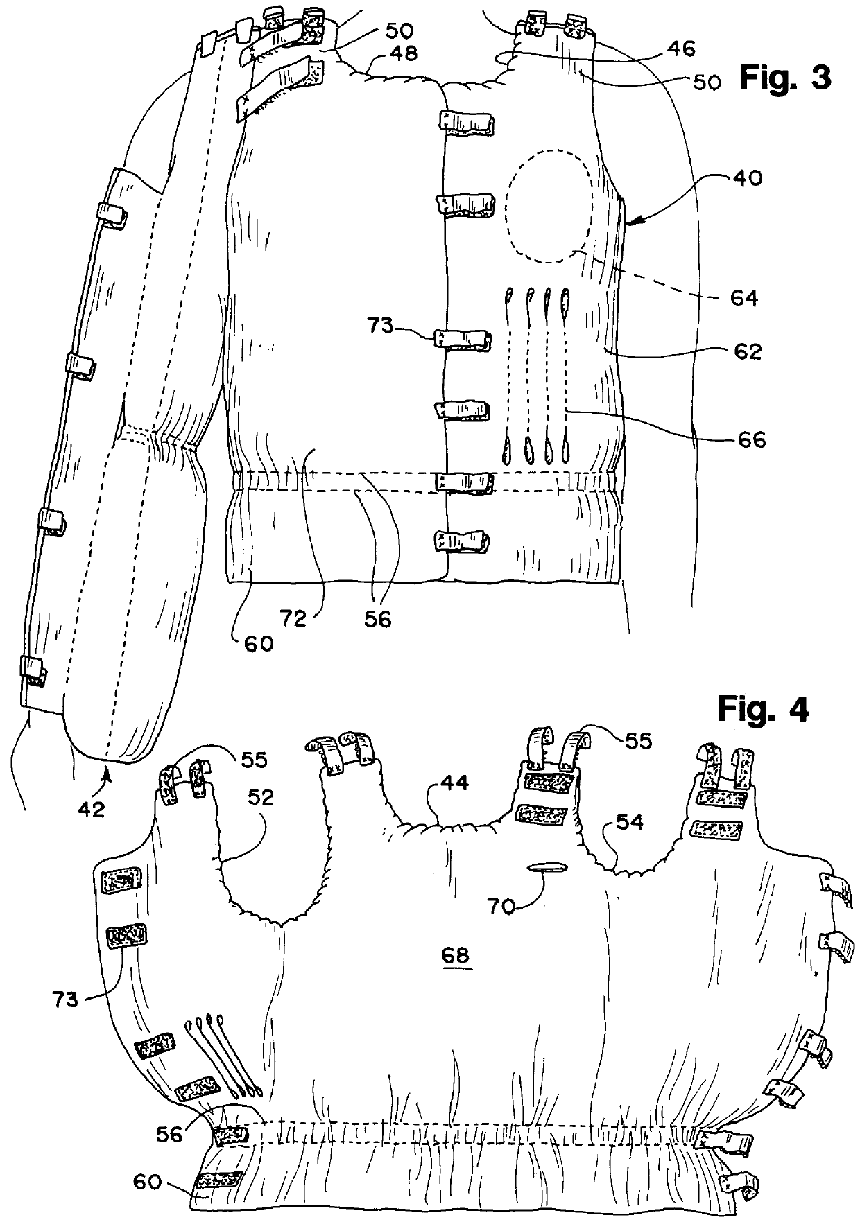 Post-mastectomy garment