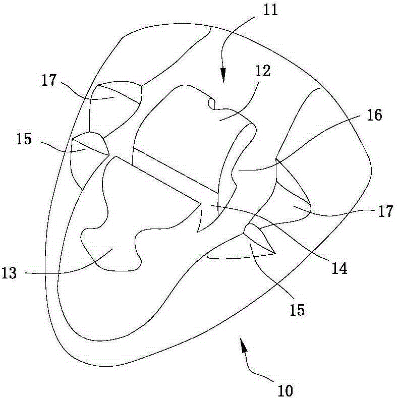 A customized lingual orthodontic bracket and its manufacturing method