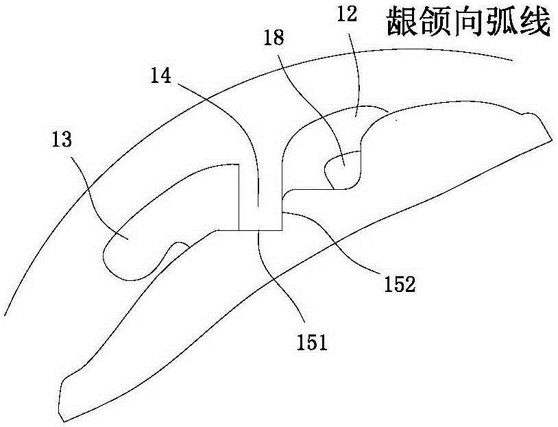 A customized lingual orthodontic bracket and its manufacturing method