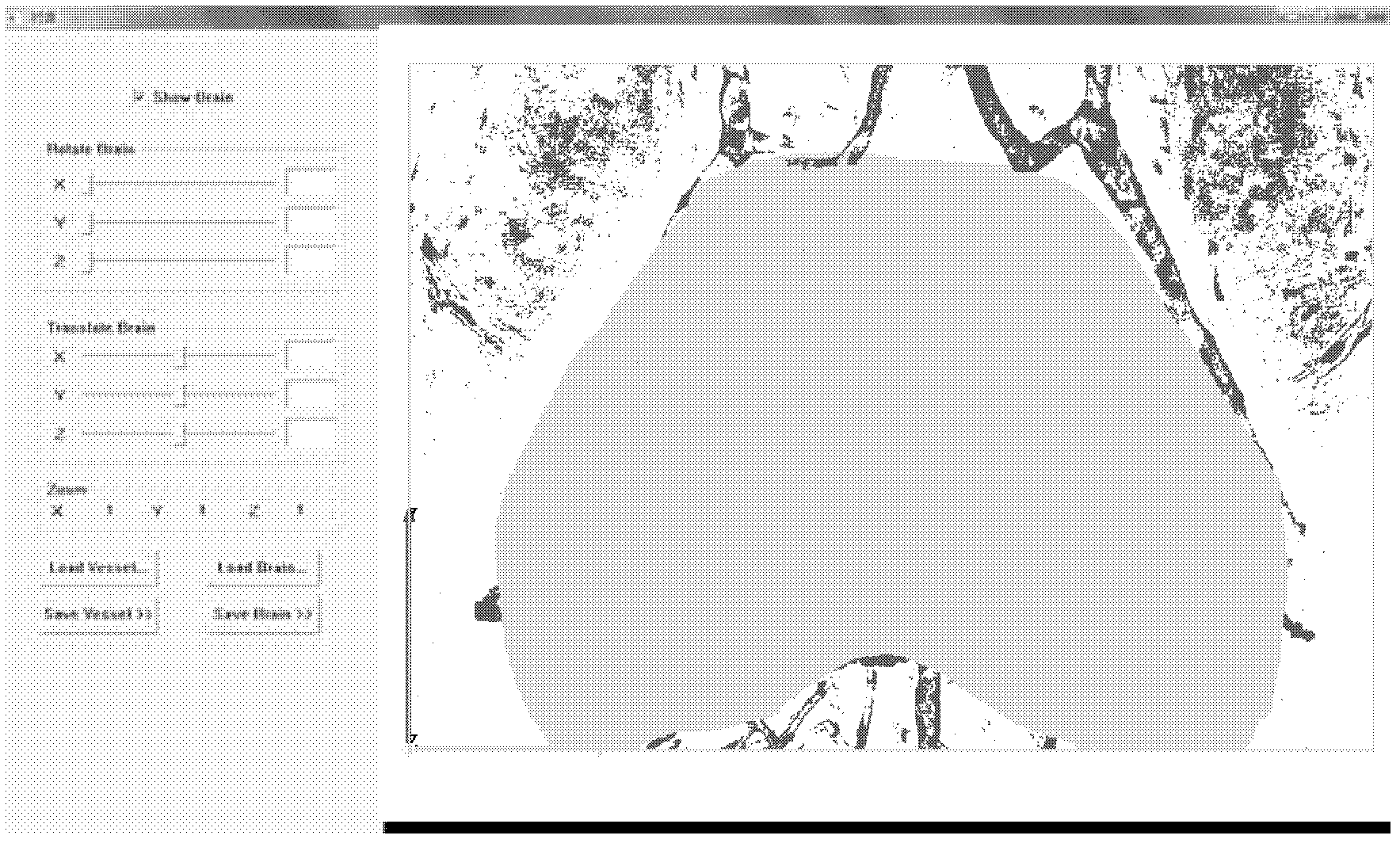 Method and system for processing and analyzing blood vessel image