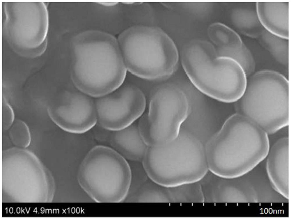 Electrolyte and lithium-ion battery