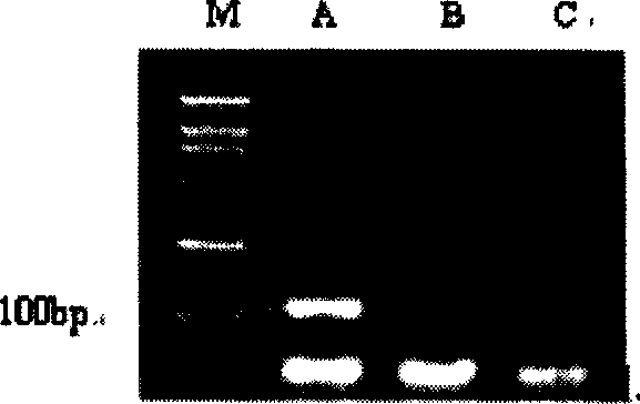 Primer and TaqMan probe for qualitative and quantitative detection of blue tongue virus