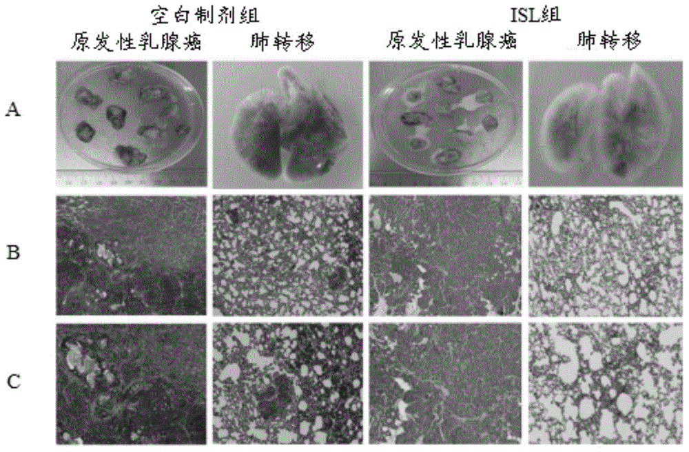 External preparation for preventing or treating breast cancer