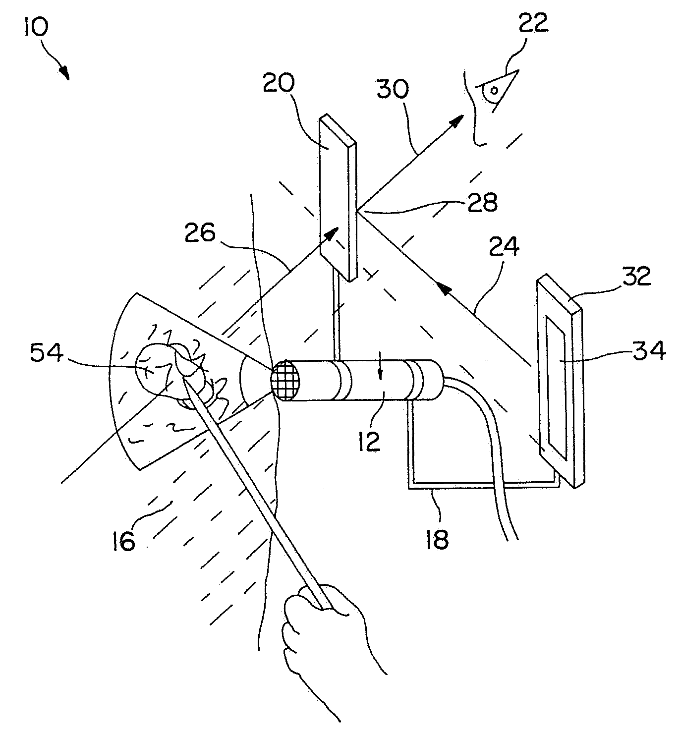 System for remote guidance by expert for imaging device