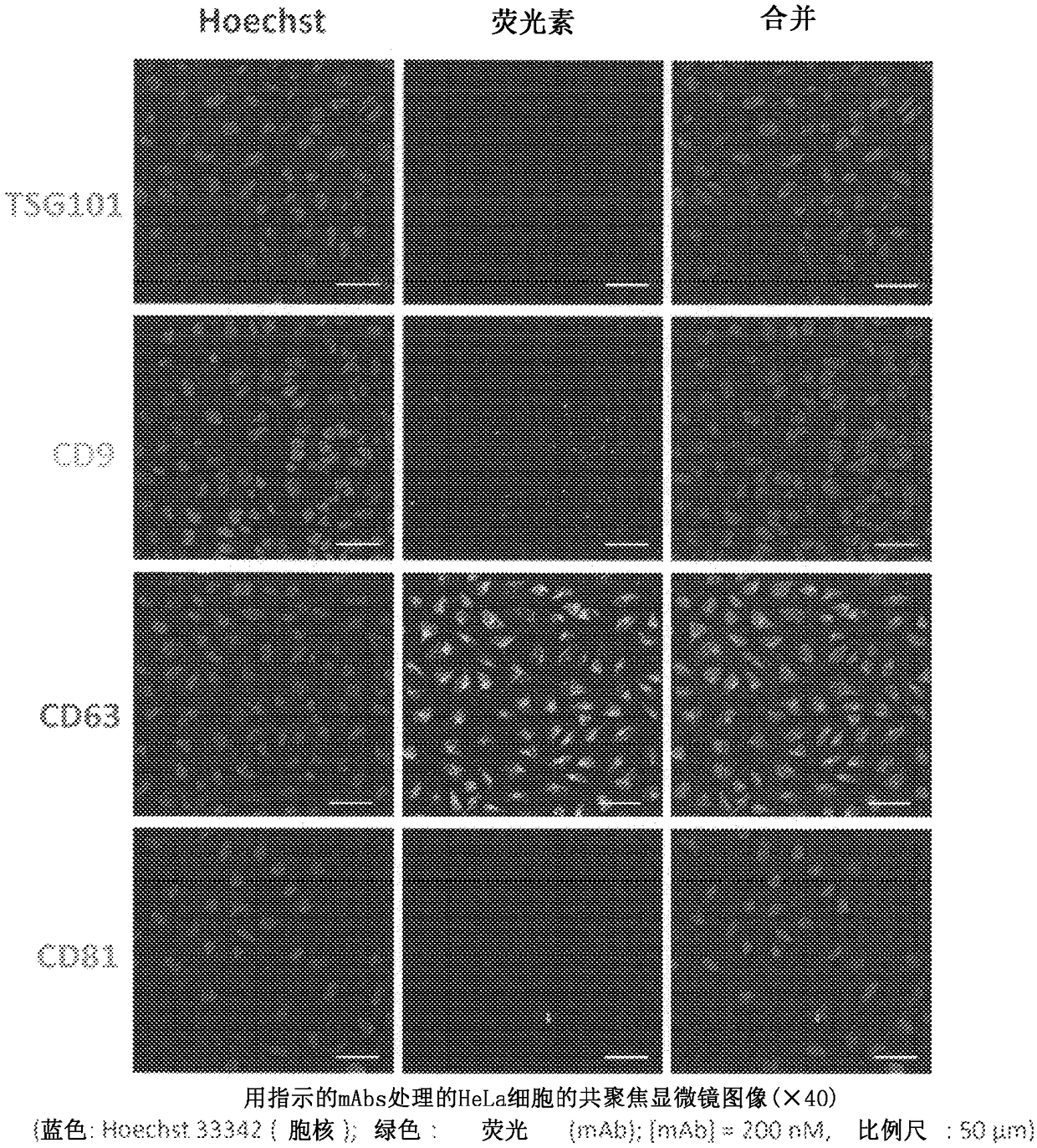 Complex capable of inhibiting genetic function in exosome, and cancer proliferation and/or metastasis suppressor