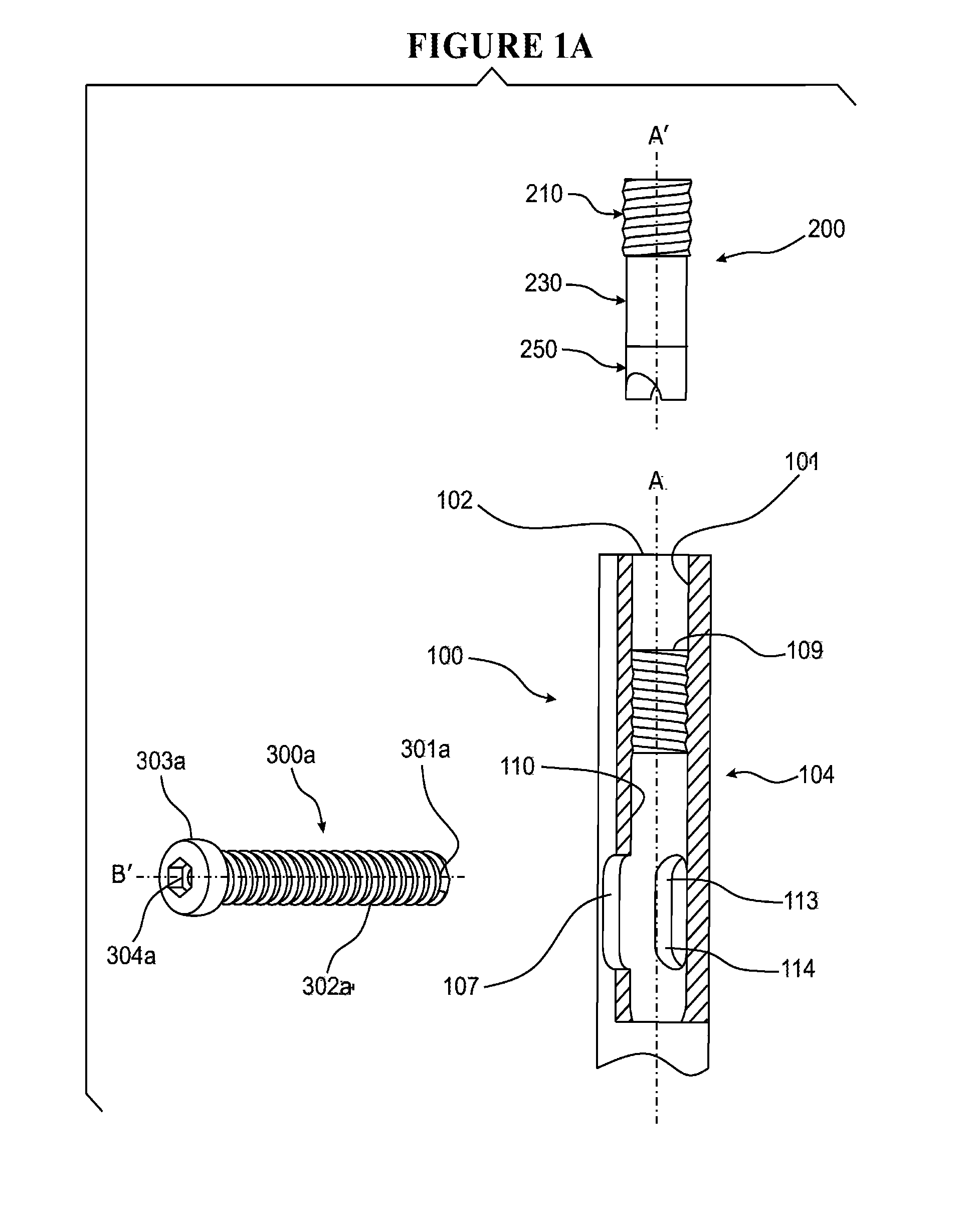 Compression device for interlocking compression nailing systems and method of use