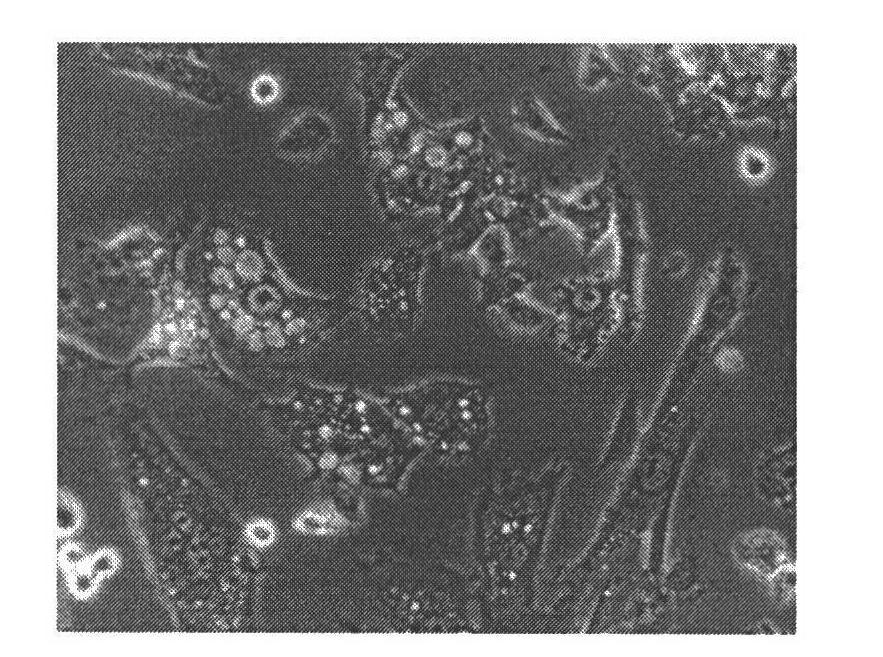 Adult nephroblastoma HANB cell strain and culturing method and application thereof