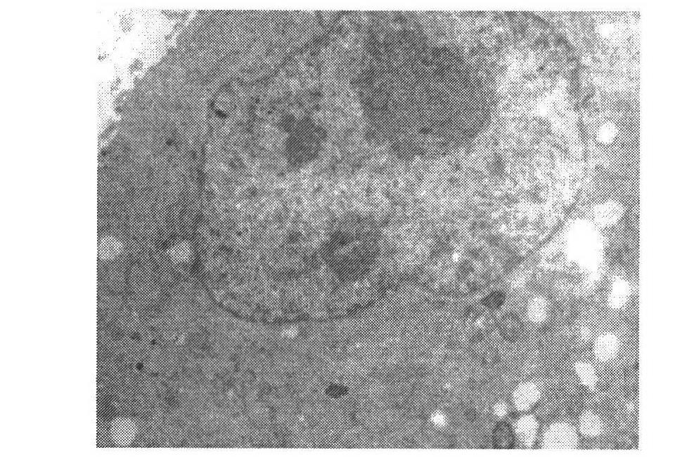 Adult nephroblastoma HANB cell strain and culturing method and application thereof