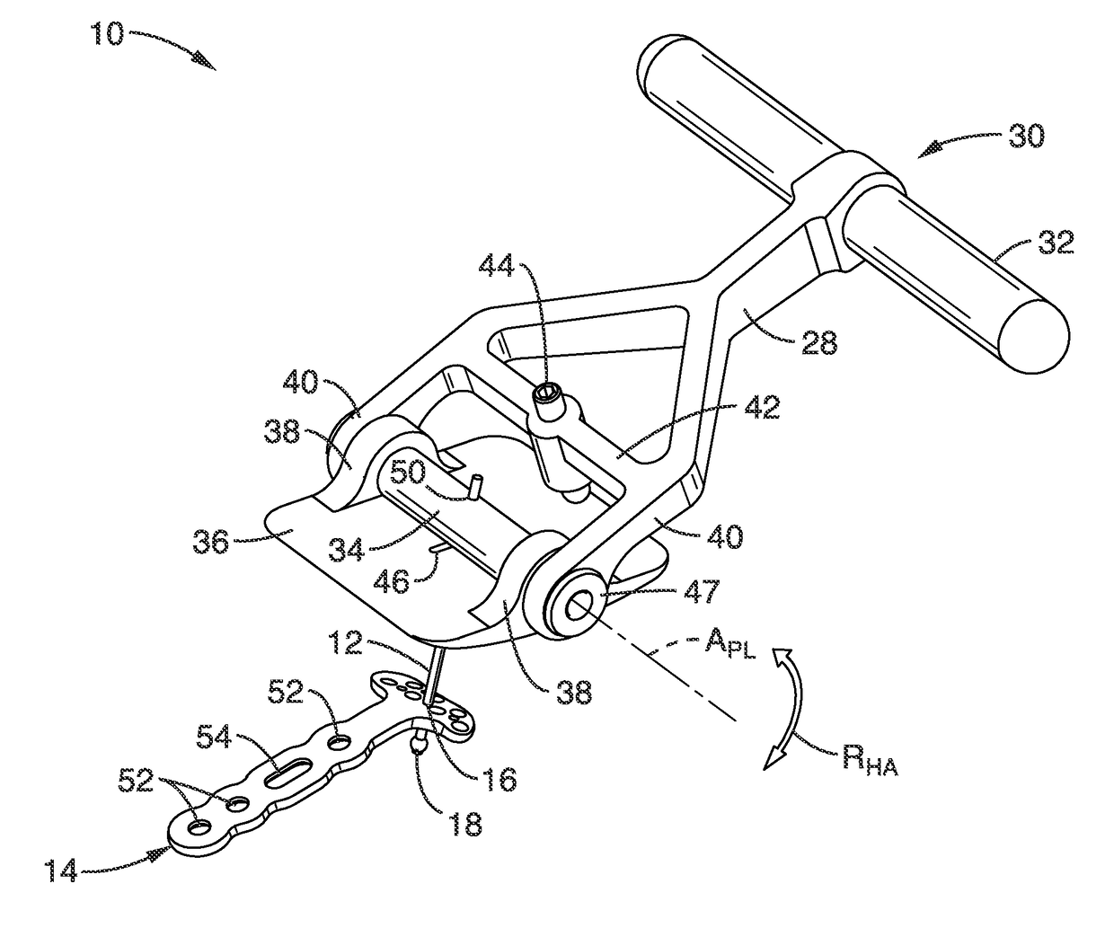 Method and apparatus for fracture reduction during internal fixation of distal radius fractures