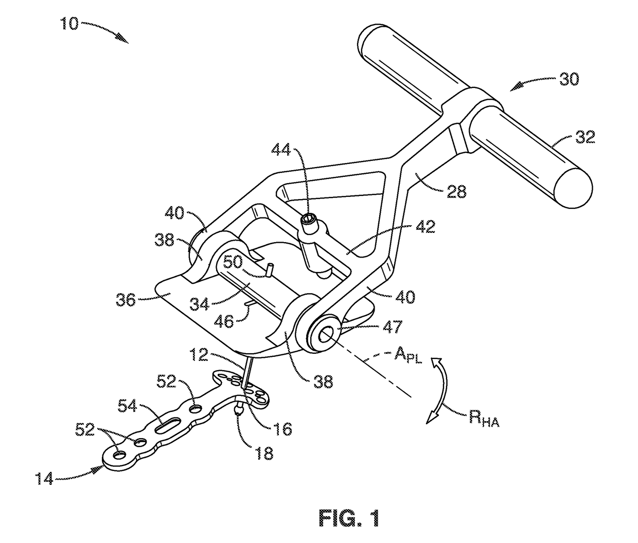 Method and apparatus for fracture reduction during internal fixation of distal radius fractures