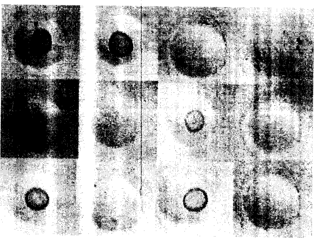 Leucodermia virus rapid detecting kit, and its preparing and using method