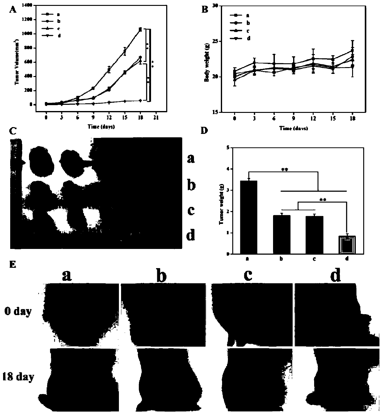 Anti-tumor combined preparation and application thereof