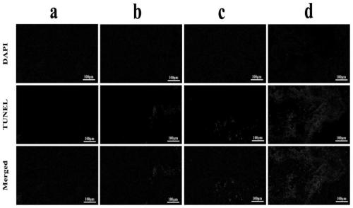 Anti-tumor combined preparation and application thereof