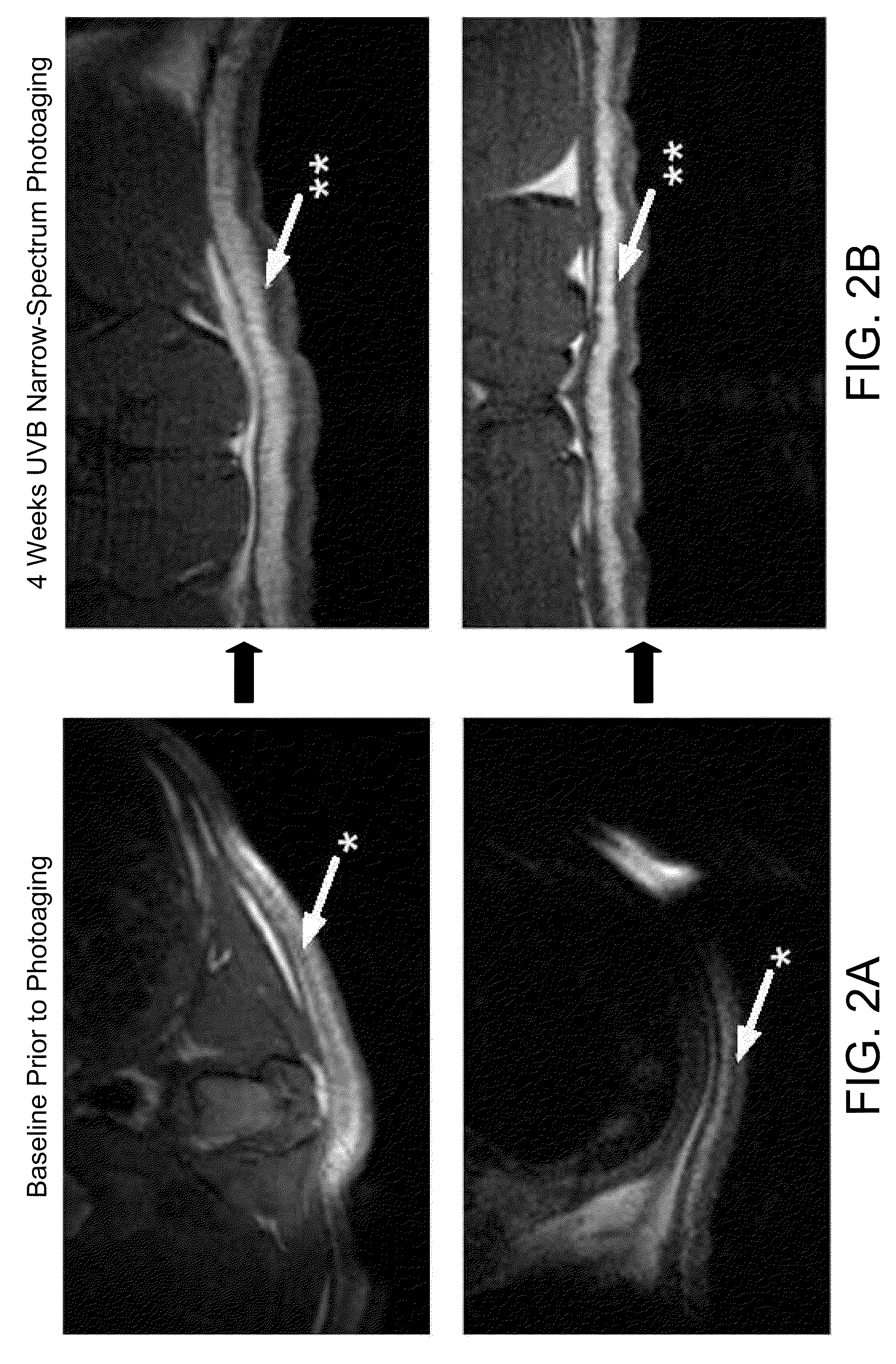 Reparative cell delivery via hyaluronic acid vehicles