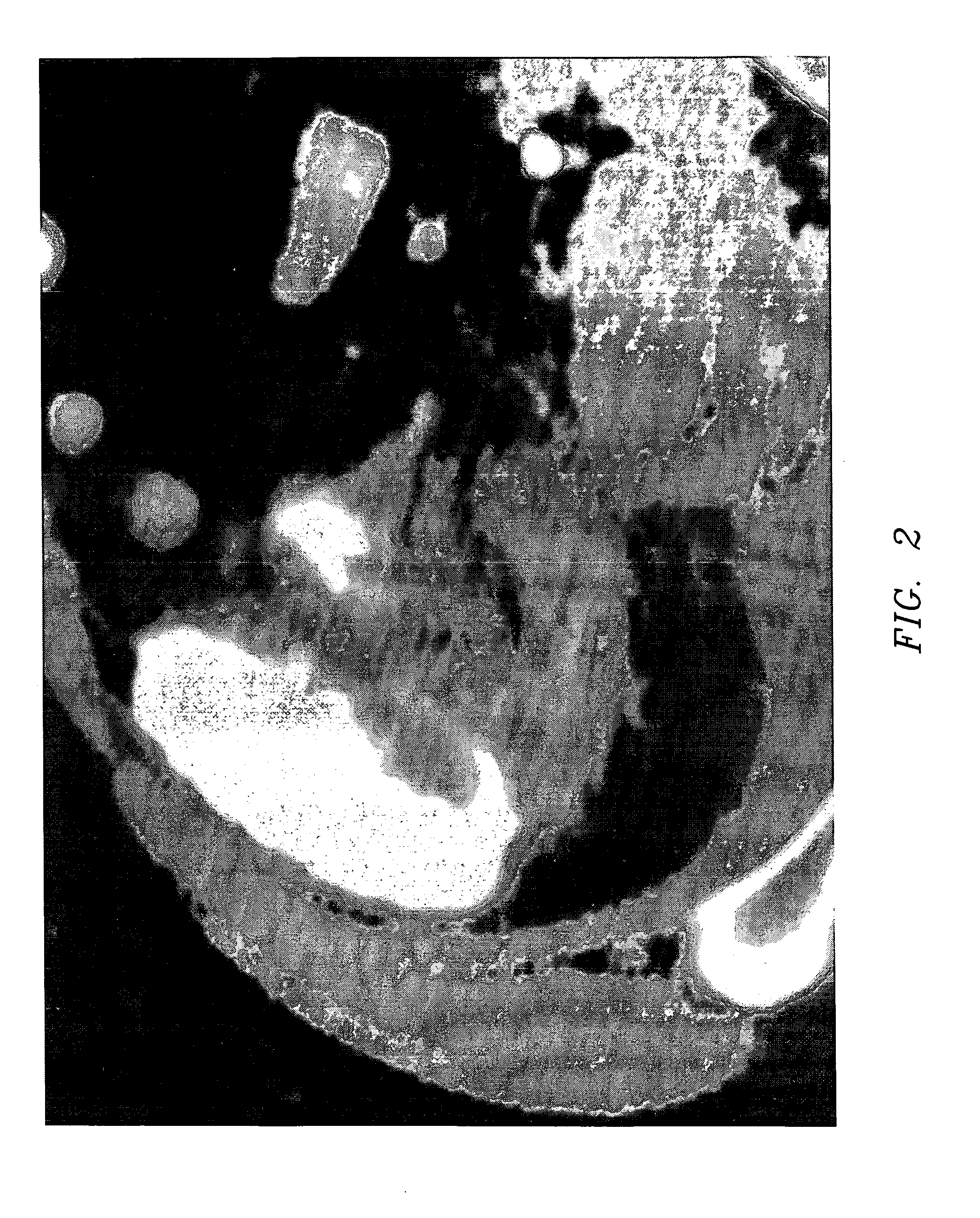 Composition and method for direct visualization of the human appendix