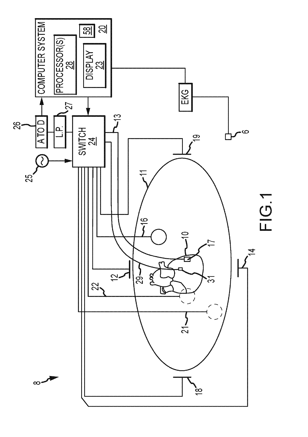 System and Method for Mapping Arrhythmic Driver Sites