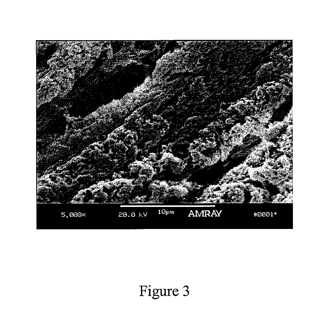 Bone matrix compositions having nanoscale textured surfaces