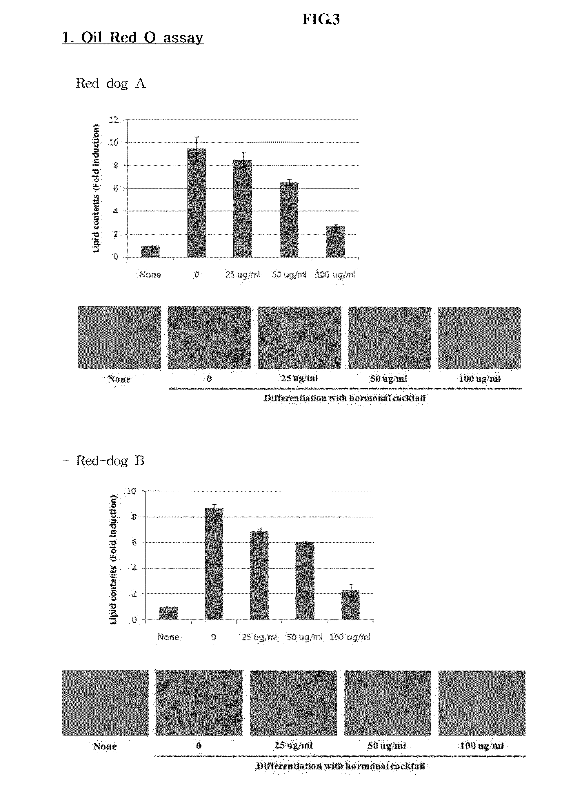 Composition for treatment of obesity using wheat bran extract or active ingredient isolated therefrom