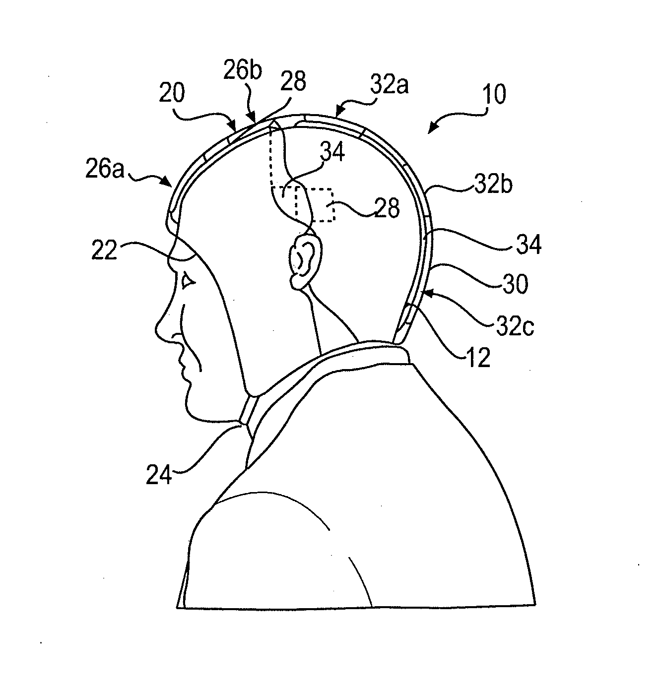 Apparatus and Method for Cooling Head Injury