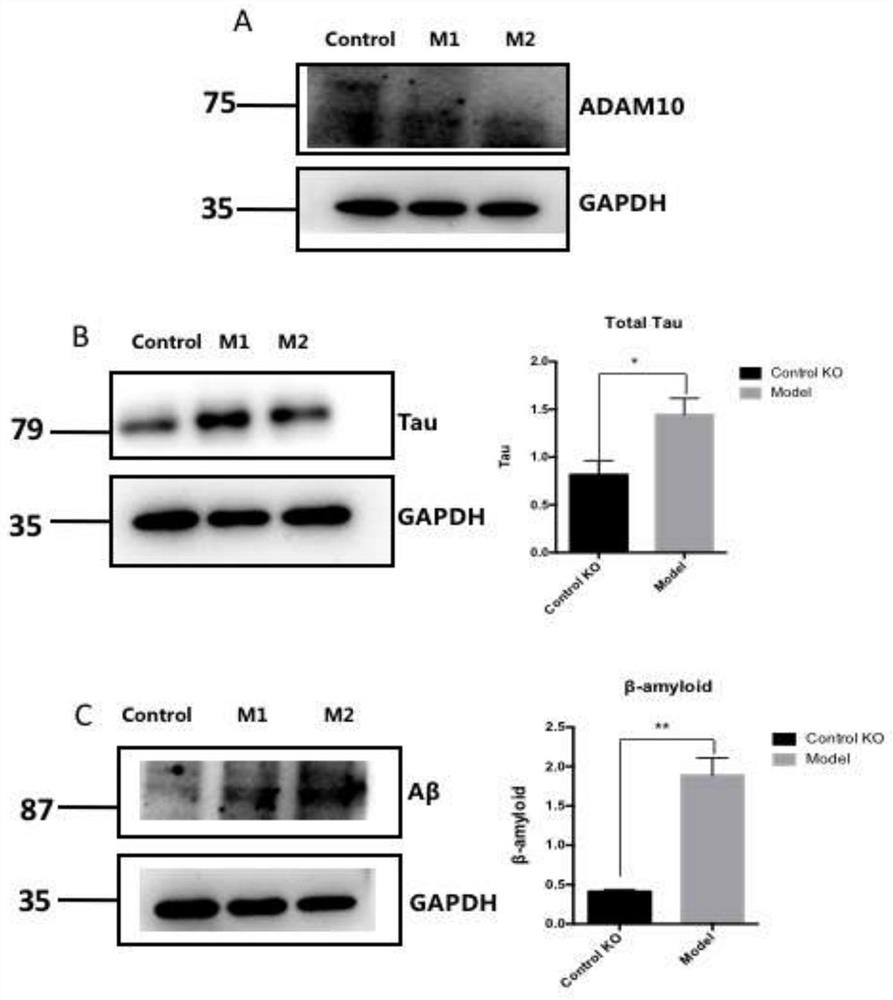 Potential protein capable of serving as Alzheimer's disease drug action target and application thereof