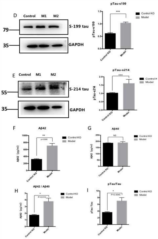 Potential protein capable of serving as Alzheimer's disease drug action target and application thereof