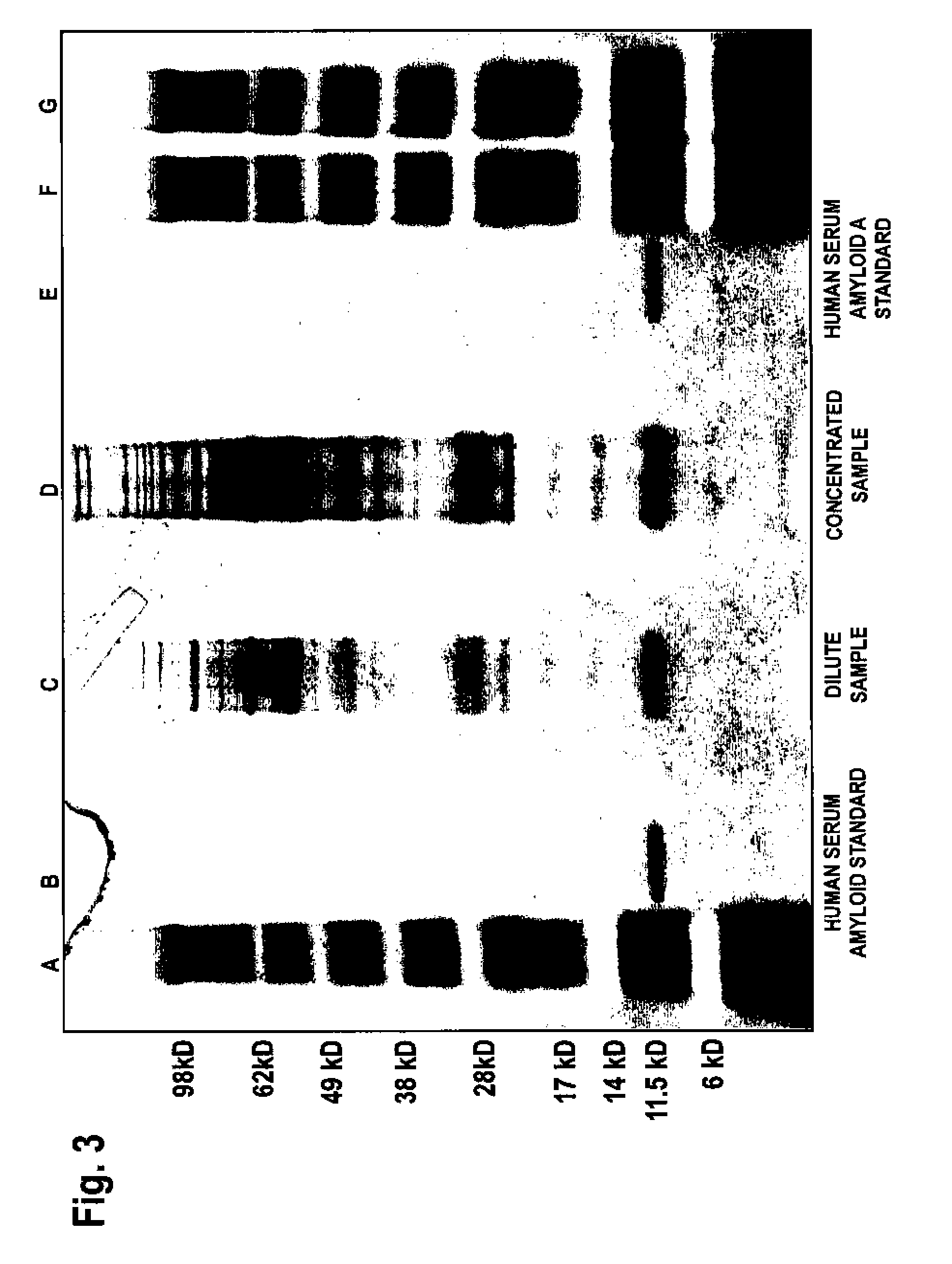 Methods and marker combinations for screening for predisposition to lung cancer