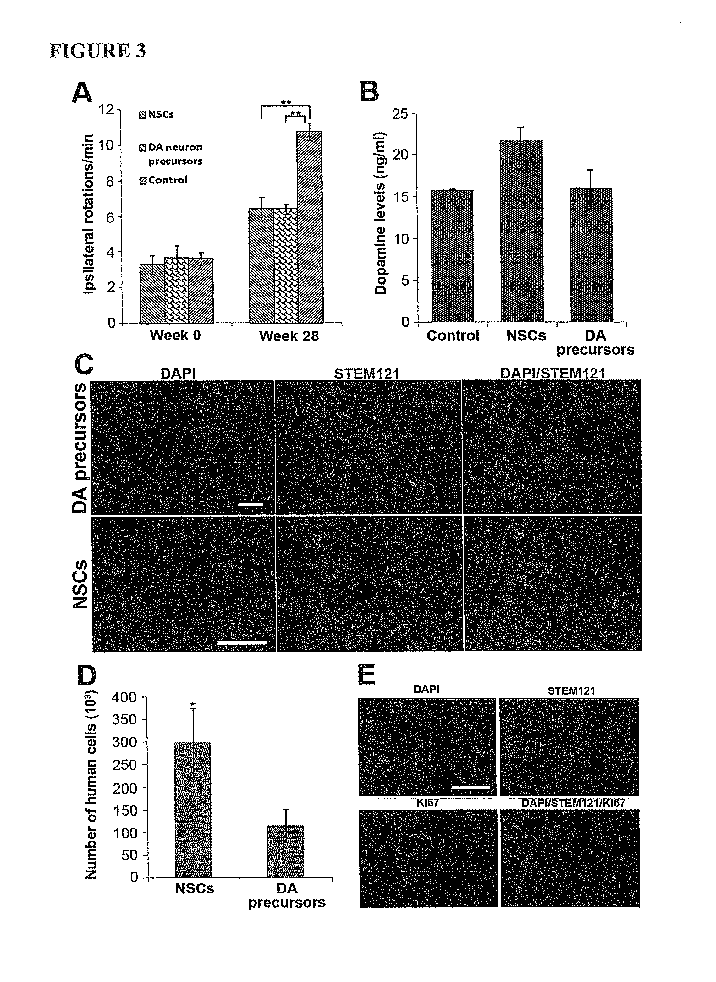 Use of neural cells derived from human pluripotent stem cells for the treatment of neurodegenerative diseases