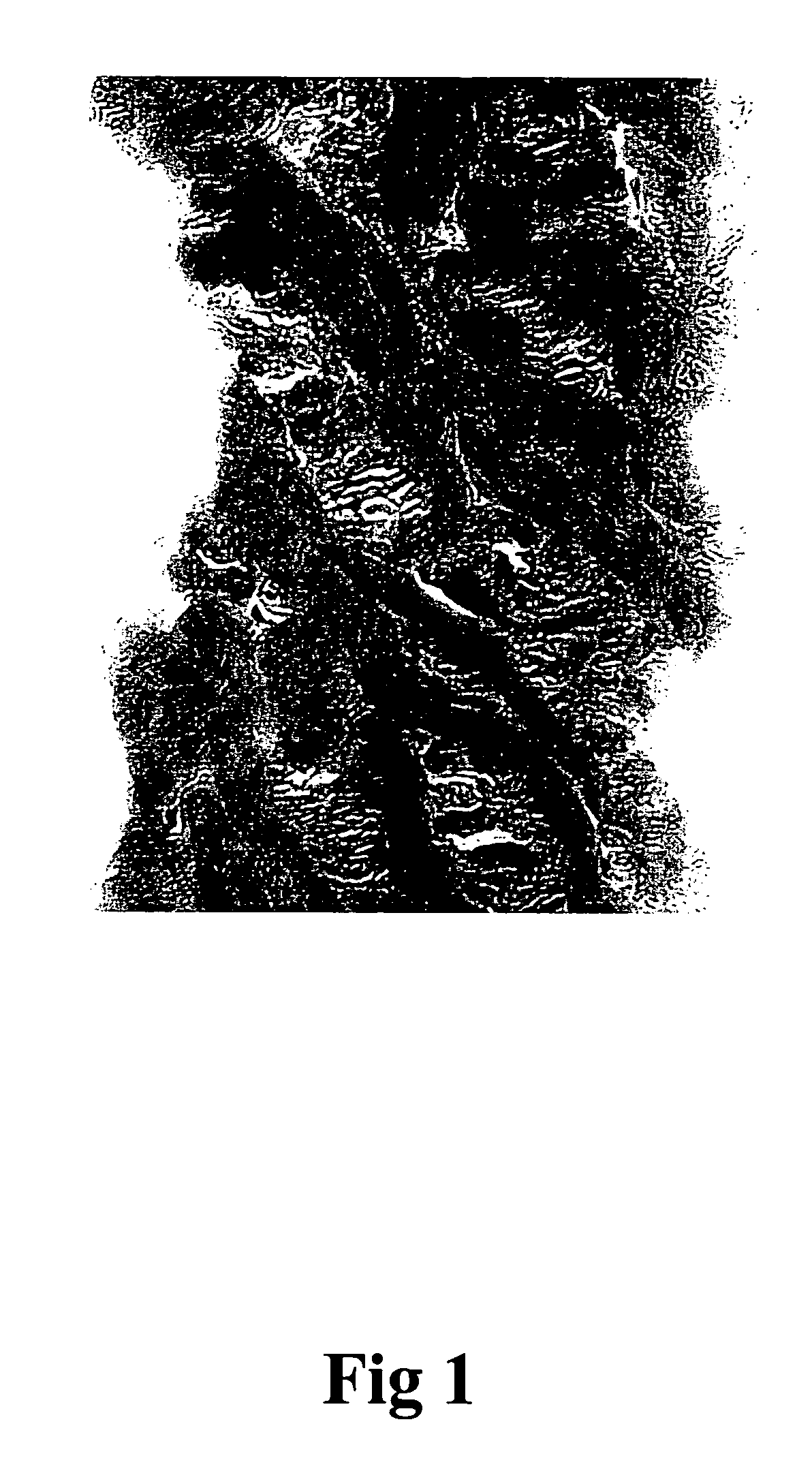 Process for preparing porous collagen matrix from connective tissue