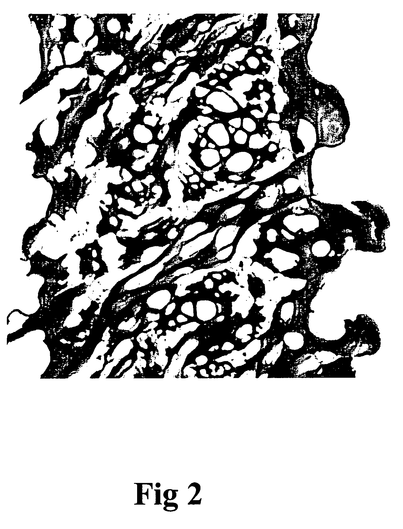 Process for preparing porous collagen matrix from connective tissue