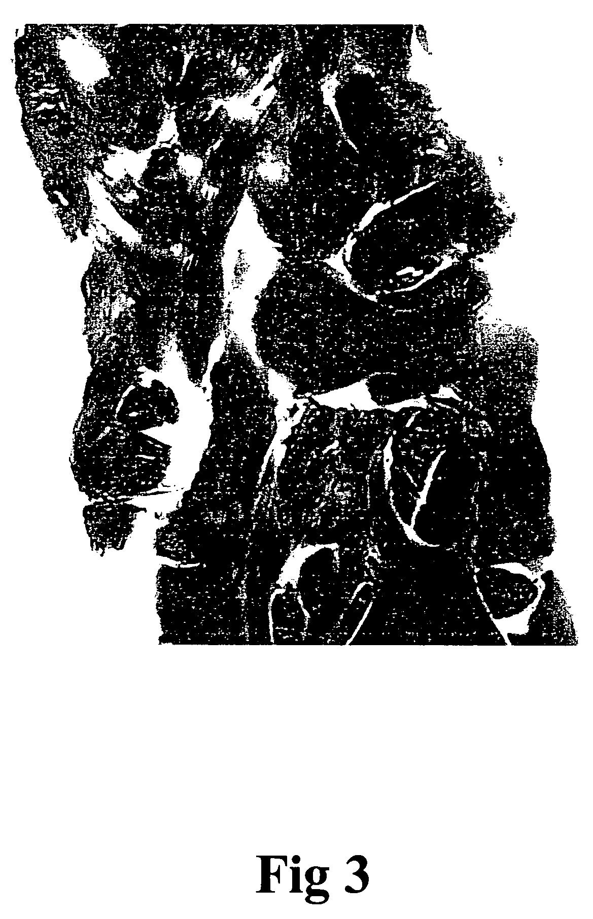 Process for preparing porous collagen matrix from connective tissue