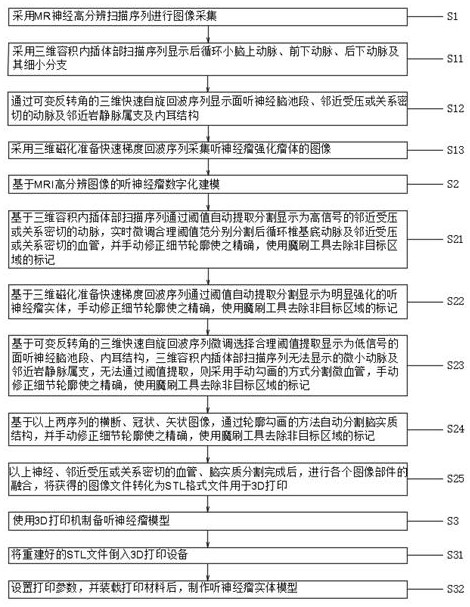 A kind of acoustic neuroma model based on mr image and preparation method thereof