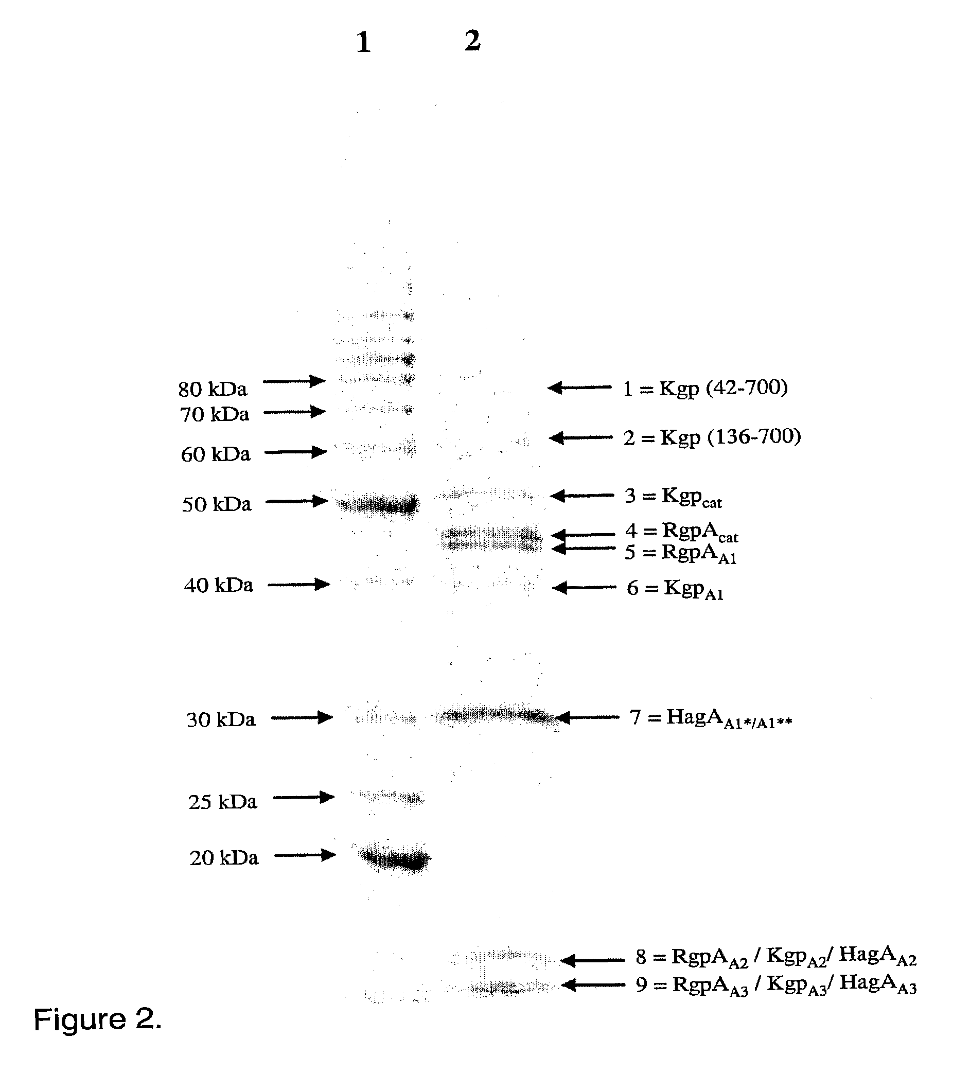 Antigenic complex for the diagnosis and treatment of porphyromonas gingivalis infection