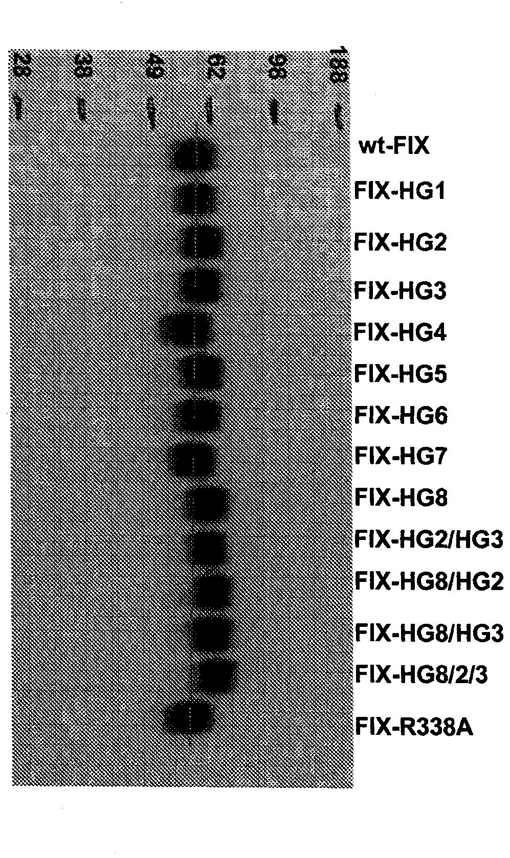 Modified factor IX polypeptides and uses thereof