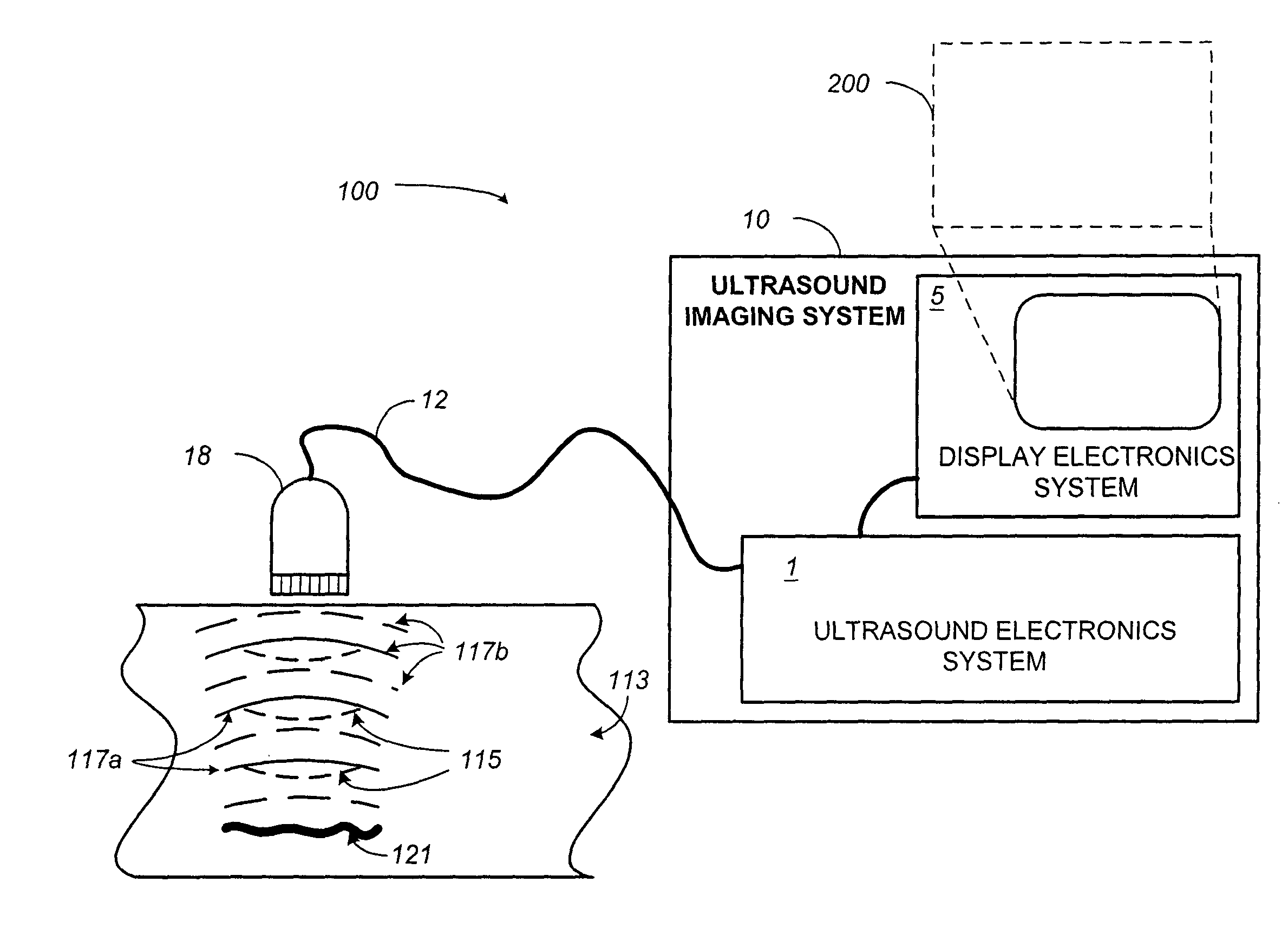 Contrast-agent enhanced color-flow imaging