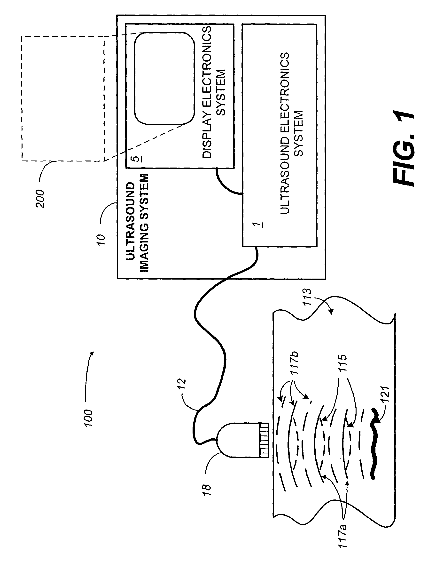 Contrast-agent enhanced color-flow imaging