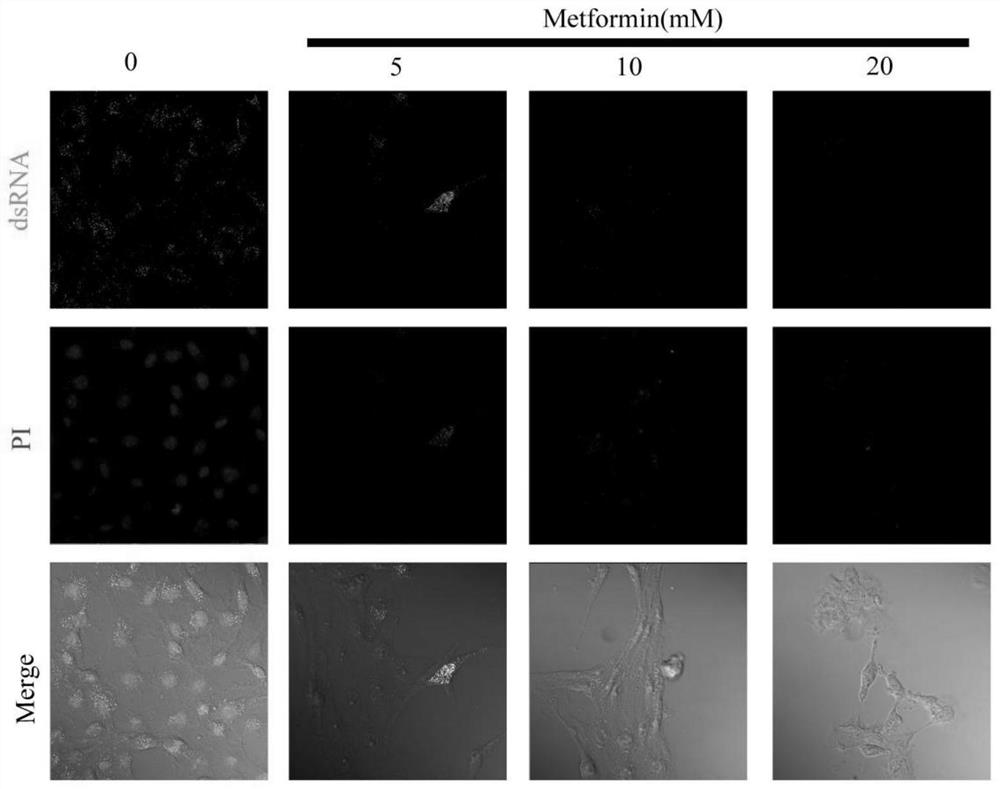 Application of Metformin in inhibiting bovine viral diarrhea virus infection