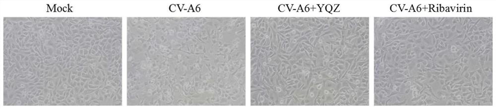 Preparation method and application of alcohol extract of flos lonicerae, herba artemisiae and fructus gardeniae prescription