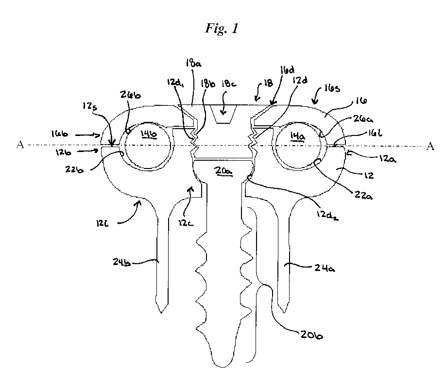 Non-fusion spinal correction systems and methods