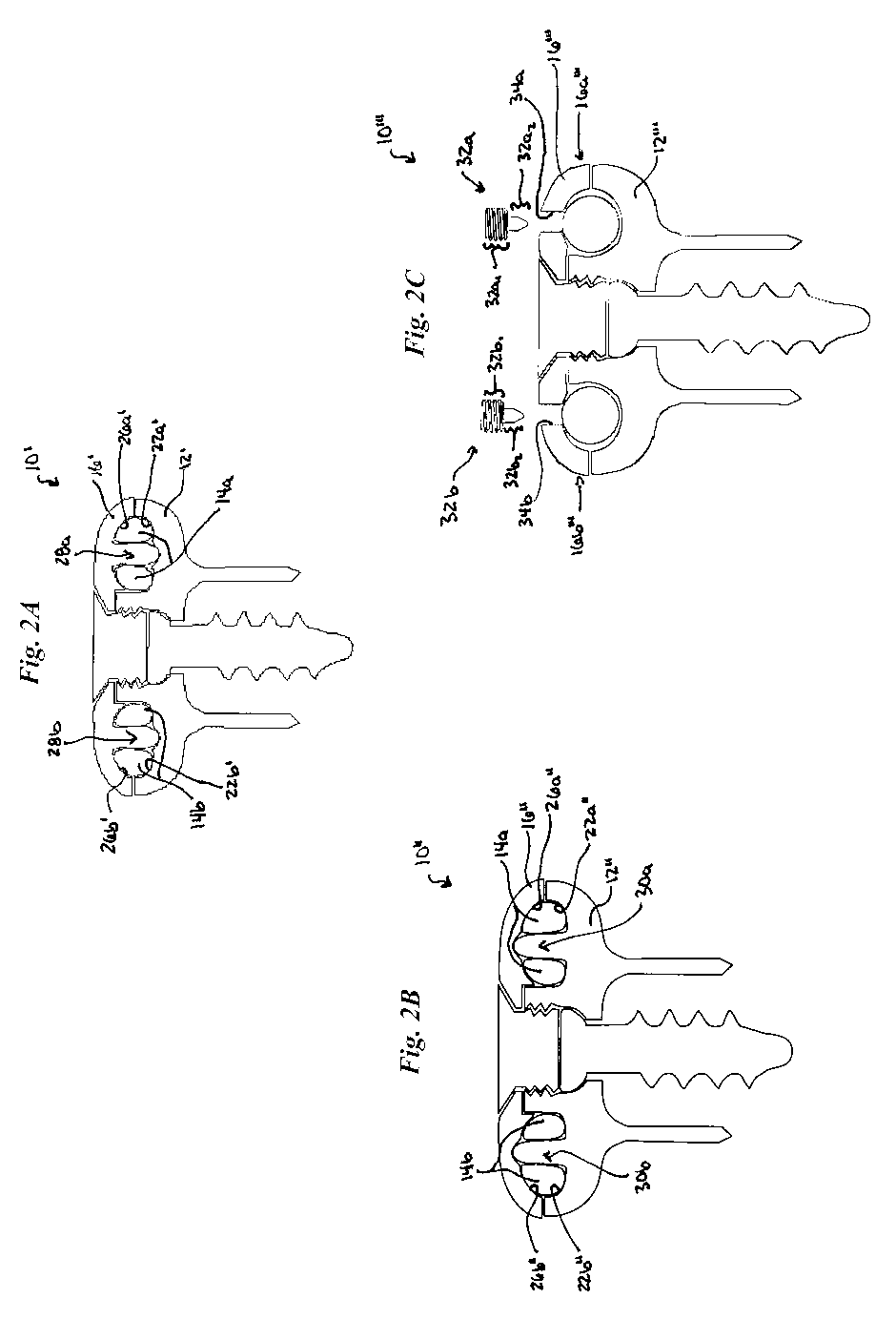 Non-fusion spinal correction systems and methods