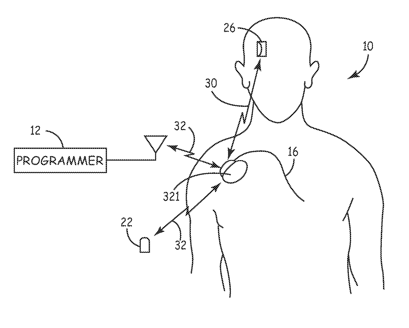 System and method for regulating cardiopulmonary triggered therapy to the brain